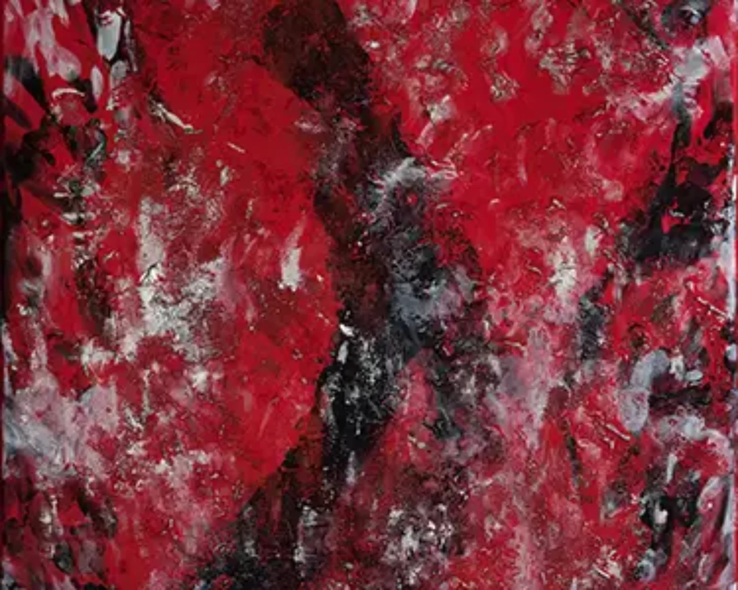 Anxiety - 375x300